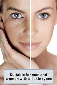 Before and after image of a woman's face highlighting skin rejuvenation results, showcasing improvement in skin texture and tone, with text stating "Suitable for men and women with all skin types."
